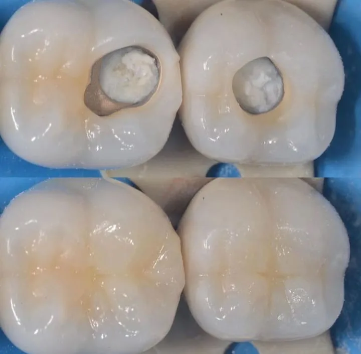 Alanya HEALTHY TEETH Dental Aesthetic — Médecine à Alanya: Commande en ligne, prix et avis