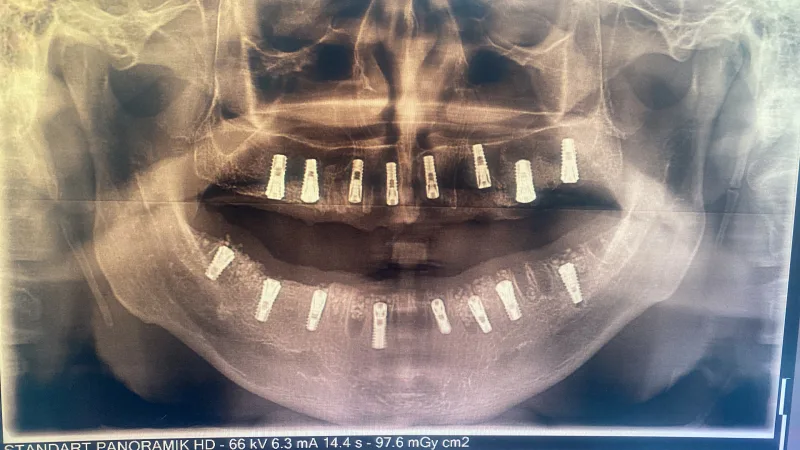 Alanya HEALTHY TEETH Dental Aesthetic — Médecine à Alanya: Commande en ligne, prix et avis