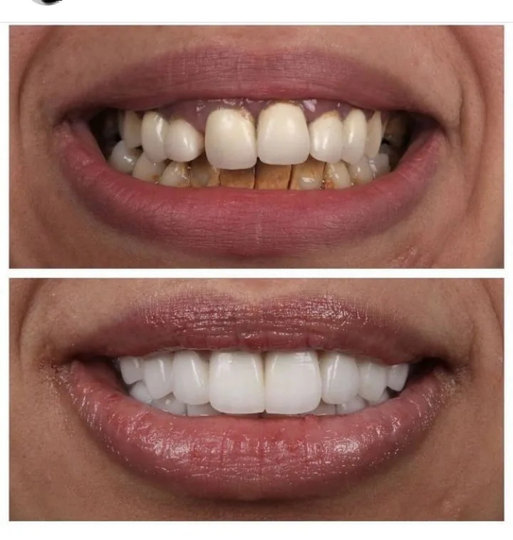 Alanya HEALTHY TEETH Dental Aesthetic — Médecine à Alanya: Commande en ligne, prix et avis