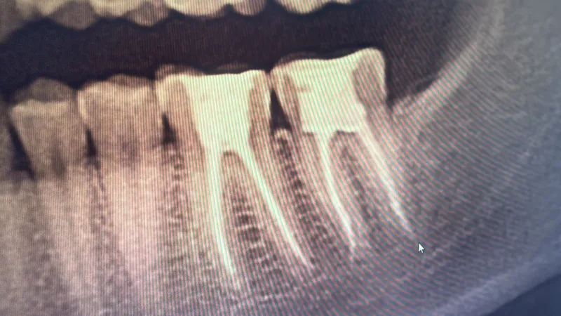 Alanya HEALTHY TEETH Dental Aesthetic — Médecine à Alanya: Commande en ligne, prix et avis