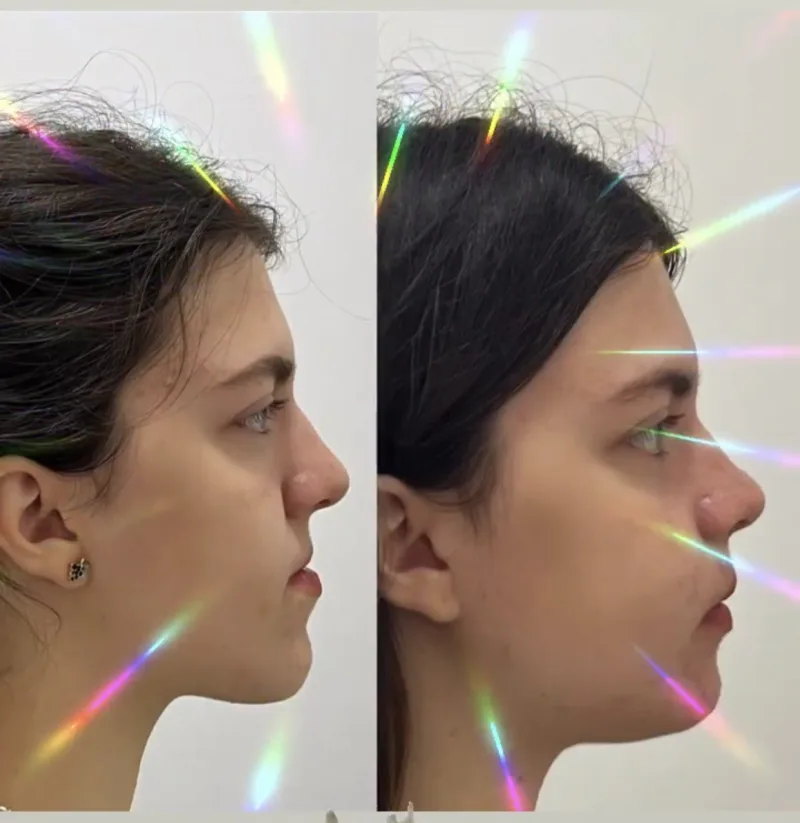 Alanya HEALTHY TEETH Dental Aesthetic — Médecine à Alanya: Commande en ligne, prix et avis